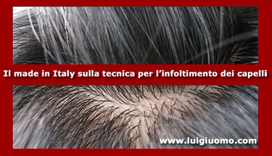 Parrucche parrucca per uomo donna Marche Ancona Ascoli Piceno Fermo  Macerata Pesaro Urbino