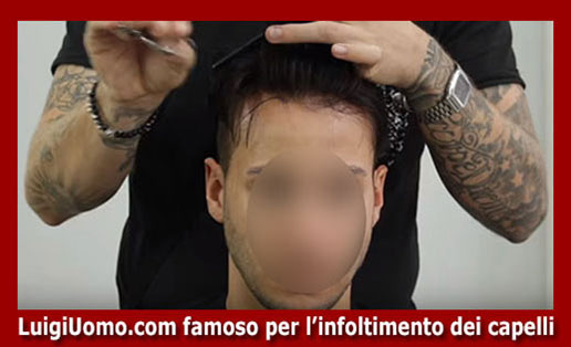 Trapianti capelli impianti capillari infoltimento capelli uomo donna Ardeatino Pietralata Collatino Alessandrino Don Bosco di modello 9