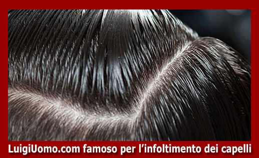 Trapianti di capelli fue uomo donna autotrapianto Palermo Ragusa Siracusa Trapani di modello 6