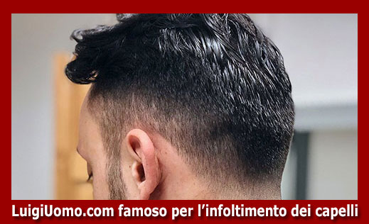 Dermatologo per caduta perdita diradamento capelli uomo donna Guidonia Montecelio Fiumicino Pomezia Tivoli di modello 11