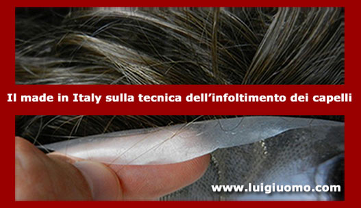 Diradamento capelli uomo donna dermatologo specialista cause Campania Avellino Benevento Caserta Napoli Salerno di modello 2