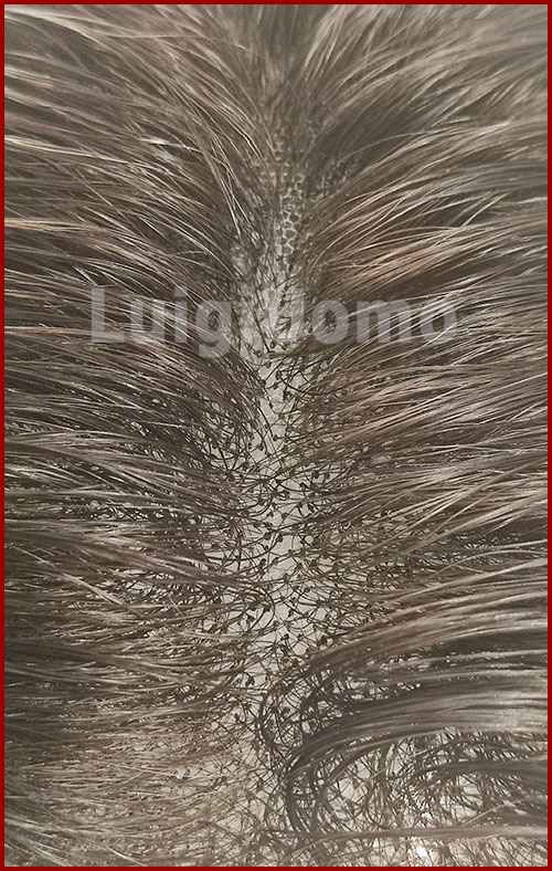 protesi capelli lace