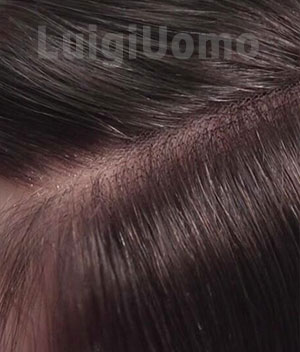 blog-image