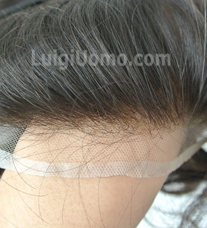 9-infoltimento-capelli-a-Milano-per-uomo-donna-non-chirurgico-