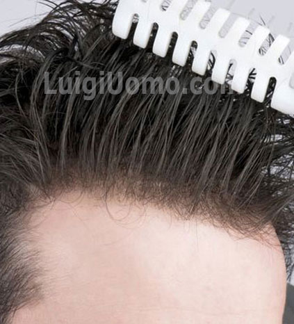 10-parrucche-parrucchino-toupee-toupet-per-uomo-e-donna-a-Reggio Calabria-