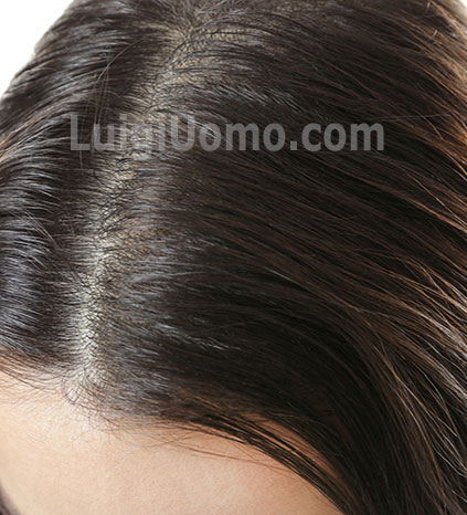 12-parrucche-parrucchino-toupee-toupet-per-uomo-e-donna-a-Renon-