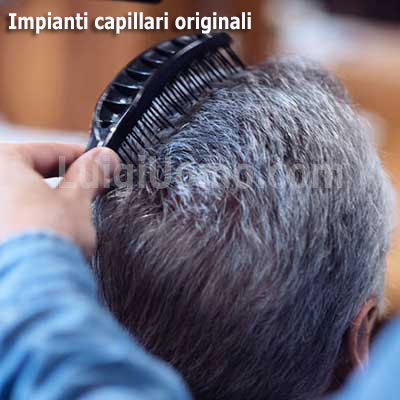 5-luigiuomo-impianti-capillari-turismo-capelli-a-Roma-infoltimento-capelli-uomo-donna