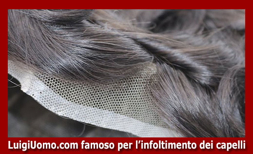 7-infoltimento-capelli-a-Catanzaro Cosenza Crotone Reggio Calabria Vibo Valentia-per-uomo-donna-non-chirurgico-