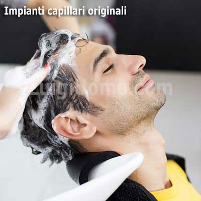 Infoltimento-capelli-non-chirurgico-uomo