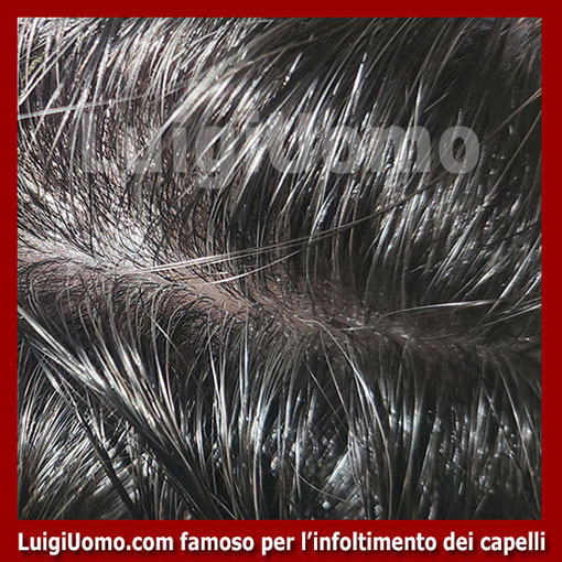 membrana-capillare-Mogliano Veneto-3
