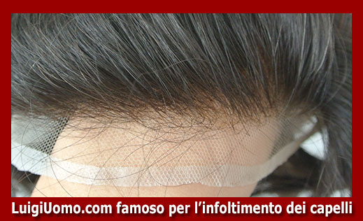 parrucche-parrucchino-toupee-toupet-per-uomo-e-donna-a-Cividale del Friuli,