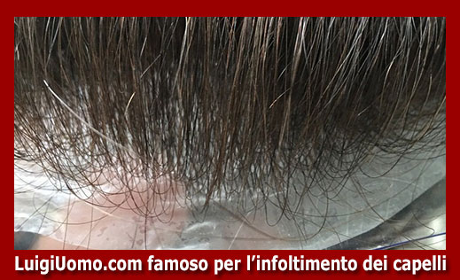11-parrucche-parrucchino-toupee-toupet-per-uomo-e-donna-a-Cagliari Carbonia Iglesias Nuoro Olbia,