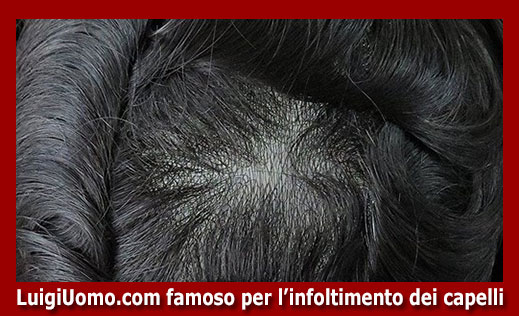 12-parrucche-parrucchino-toupee-toupet-per-uomo-e-donna-a-Borgo Valsugana ,