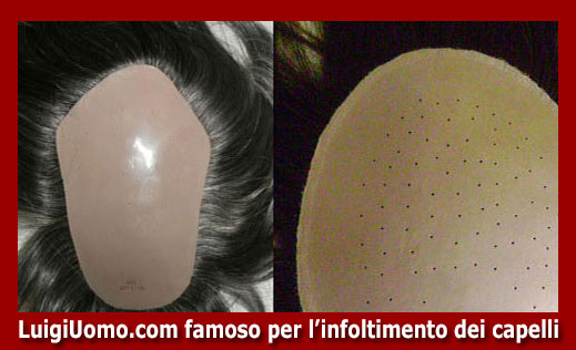 14-parrucche-parrucchino-toupee-toupet-per-uomo-e-donna-a-Cividale del Friuli,