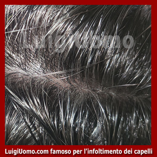 Patch-cutanea-Rapallo-3