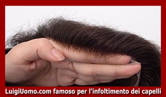 protesi capelli uomo milano