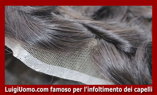 protesi di capelli Riva del Garda - modello 3 - protesi-di-capelli-Riva del Garda