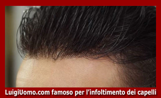 Protesi di capelli arezzo - modello 10 - protesi-di-capelli-Arezzo