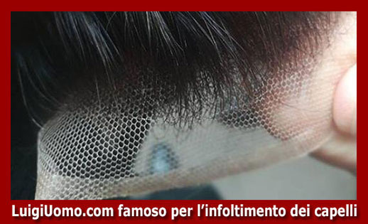 protesi di capelli Riva del Garda - modello 2 - protesi-di-capelli-Riva del Garda