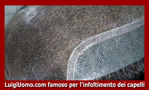 protesi di capelli San Giovanni Teatino - modello 4 - protesi-di-capelli-San Giovanni Teatino