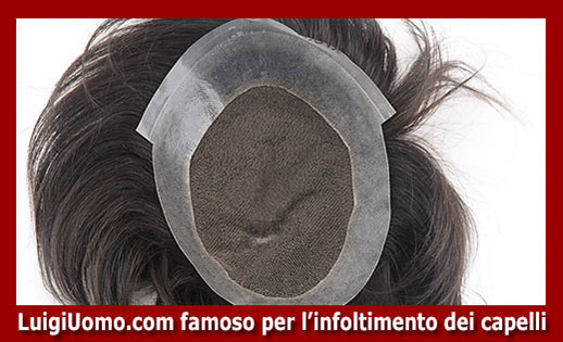 protesi di capelli Lavello - modello 5 - protesi-di-capelli-Lavello