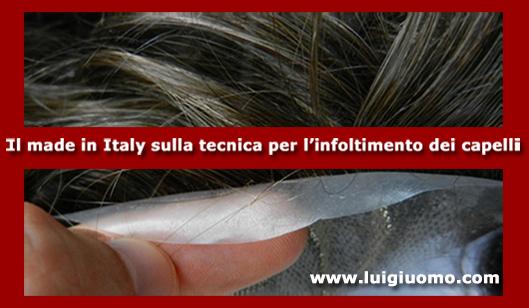 Impianti capelli Impianti tricologici Protesi tricologiche uomo donna Latina di modello 10