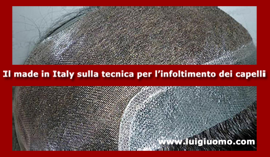 Impianti capelli Impianti tricologici Protesi tricologiche uomo donna Latina di modello 12