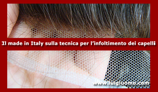 Impianti capelli Impianti tricologici Protesi tricologiche uomo donna Labaro Prima Porta Polline Martignano di modello 3