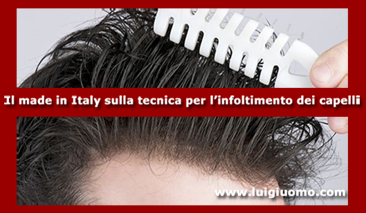 Impianti capelli Impianti tricologici Protesi tricologiche uomo donna Palombara Sabina Formello Monte Compatri Campagnano di Roma di modello 4
