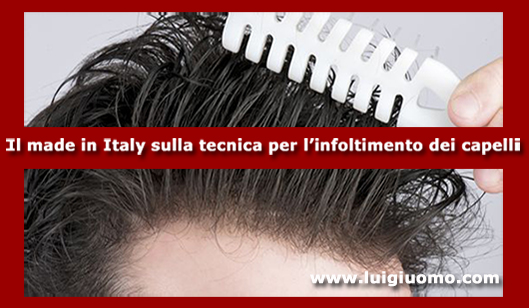 Impianti capelli Impianti tricologici Protesi tricologiche uomo donna Monterotondo Marino Albano Laziale Ladispoli Ciampino di modello 4