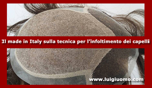 Impianti capelli Impianti tricologici Protesi tricologiche uomo donna Latina di modello 5
