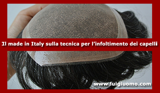 Impianti capelli Impianti tricologici Protesi tricologiche uomo donna Latina di modello 6