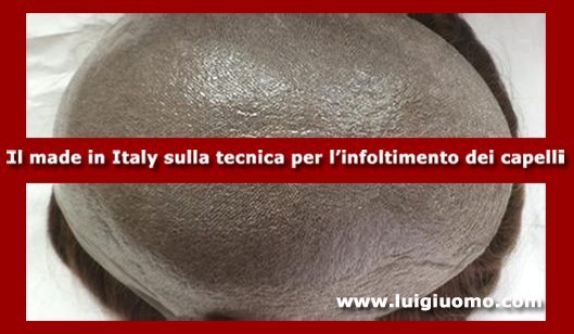 Impianti capelli Impianti tricologici Protesi tricologiche uomo donna Isola Sacra Fiumicino Fregene Tor di Valle Magliana di modello 7