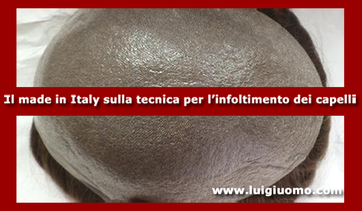 Impianti capelli Impianti tricologici Protesi tricologiche uomo donna Latina di modello 7