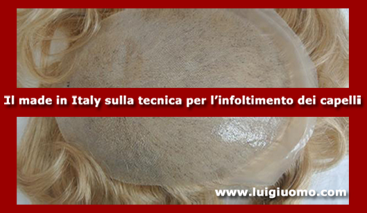 Impianti capelli Impianti tricologici Protesi tricologiche uomo donna Cerveteri Fonte Nuova Genzano di Roma Colleferro Mentana di modello 8