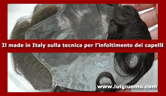 Impianti capelli Impianti tricologici Protesi tricologiche uomo donna Frascati Palestrina Grottaferrata Bracciano Anguillara Sabazia di modello 9