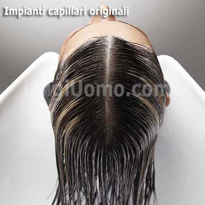 Infoltimento-capelli-di-ultima-generazione
