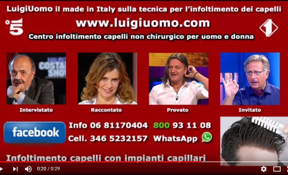 luigiUomo-protesi-capelli