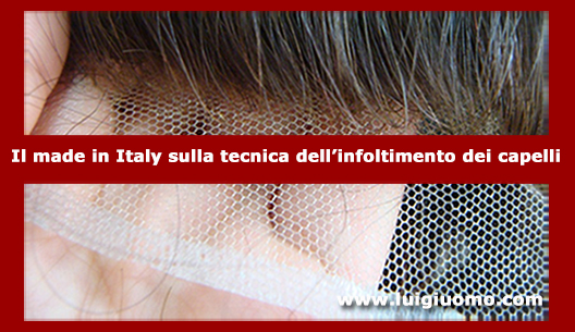 Caduta capelli dermatologo specialista cause per uomo donna Piemonte Alessandria Asti Biella Cuneo Novara di Protesi capelli 3