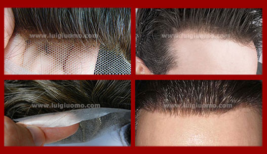 Diradamento capelli uomo donna dermatologo specialista cause Liguria Genova Imperia La Spezia Savona di modello 1