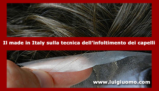 Diradamento capelli uomo donna dermatologo specialista cause Liguria Genova Imperia La Spezia Savona di modello 2