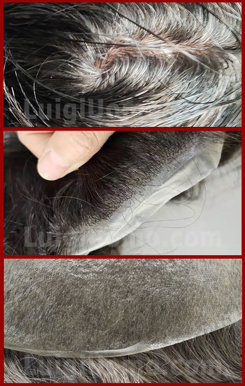 Costo-Patch-cutanea
