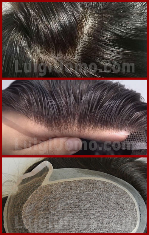 impianto-capillare-originale-parziale-totale
