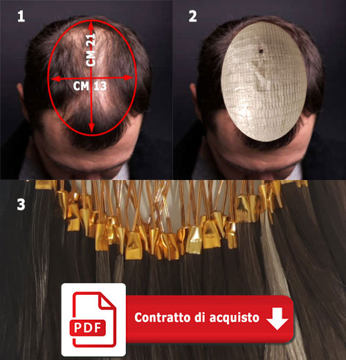 Costo-Patch-cutanea