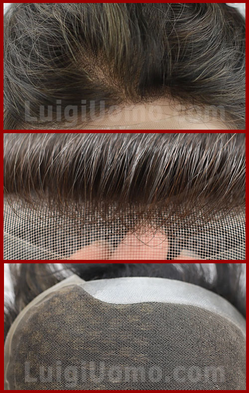 Prezzo Protesi capelli