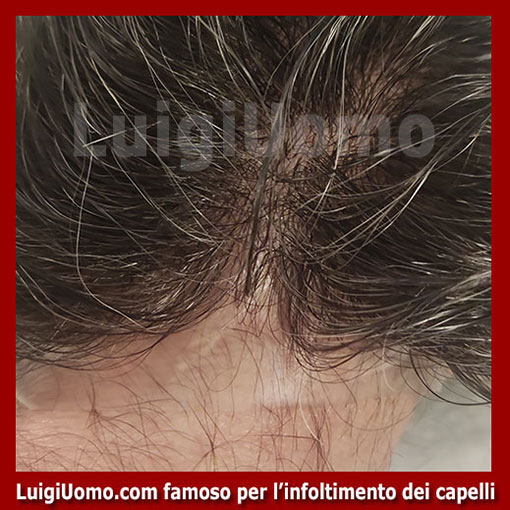 membrana-capillare-Vipiteno-1