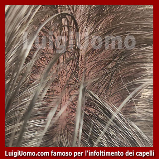 membrana-capillare-Vipiteno-2