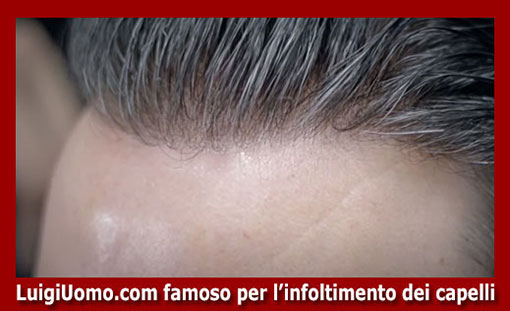 membrana-capillare-Vipiteno-6