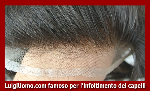 parrucche-parrucchino-toupee-toupet-per-uomo-e-donna-a-Genova,