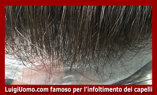11-parrucche-parrucchino-toupee-toupet-per-uomo-e-donna-a-Genova,